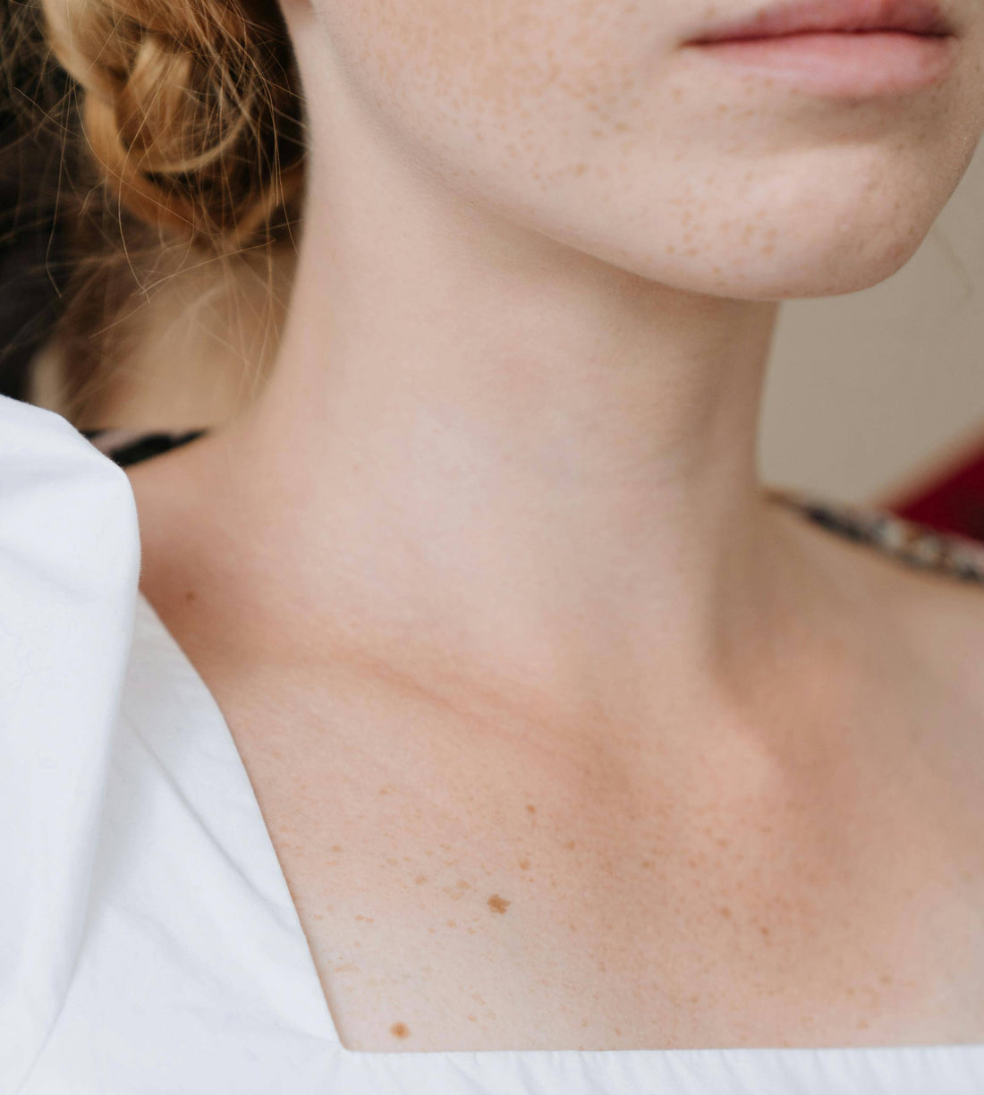 Kaklo limfadenopatija