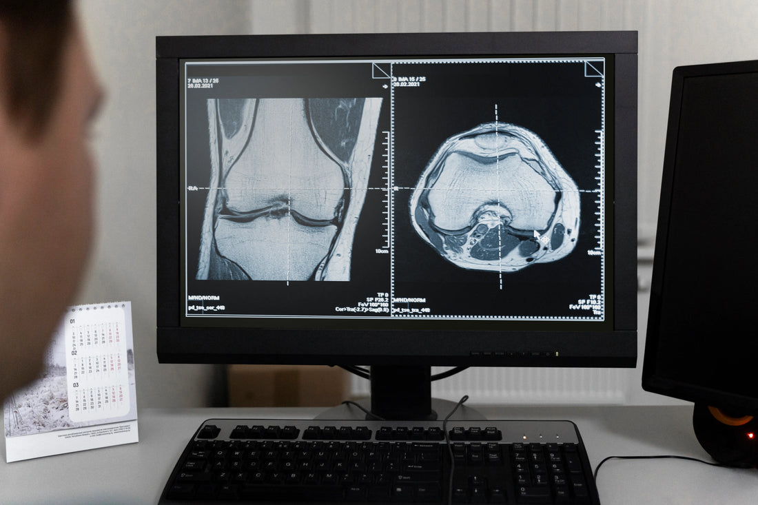 Kineziterapija po kelio sąnario endoprotezavimo